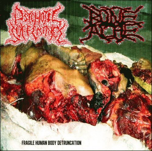 Psychotic Sufferance : Fragile Human Body Detruncation